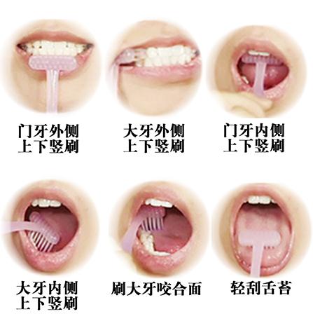 正确的刷牙方式